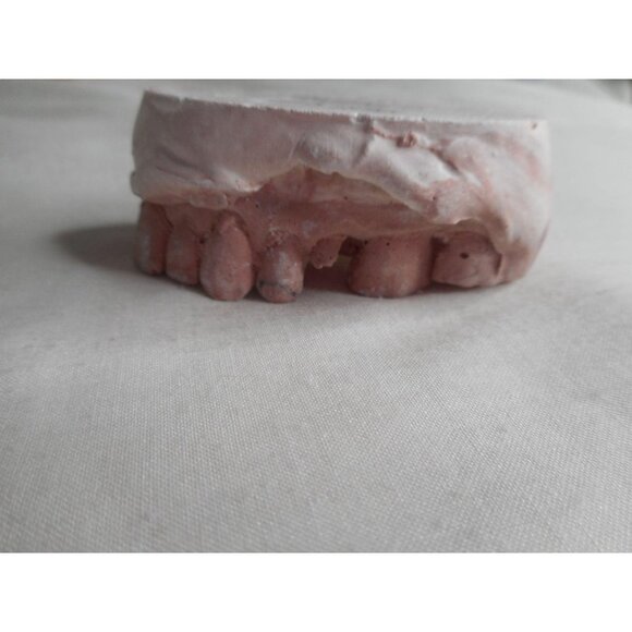 Vintage Cast Dental Teeth Mold  Tooth Castings #11 - Picture 4 of 5